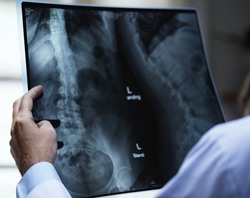 Bell CA doctor examining x-ray